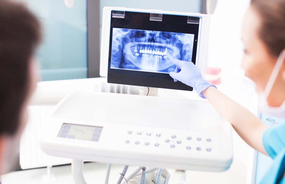 Dental x-ray being shown to a patient