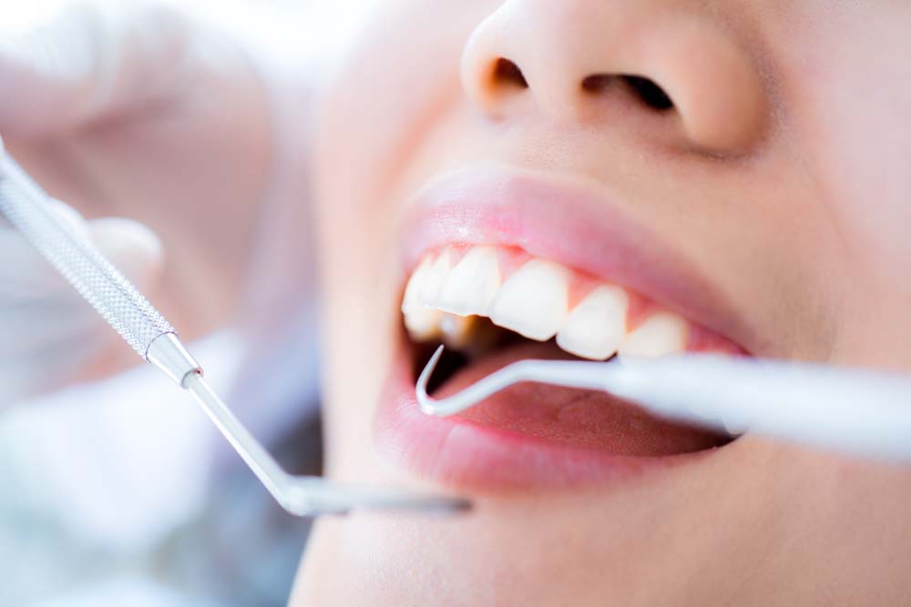 Dentist performing a dental cleaning